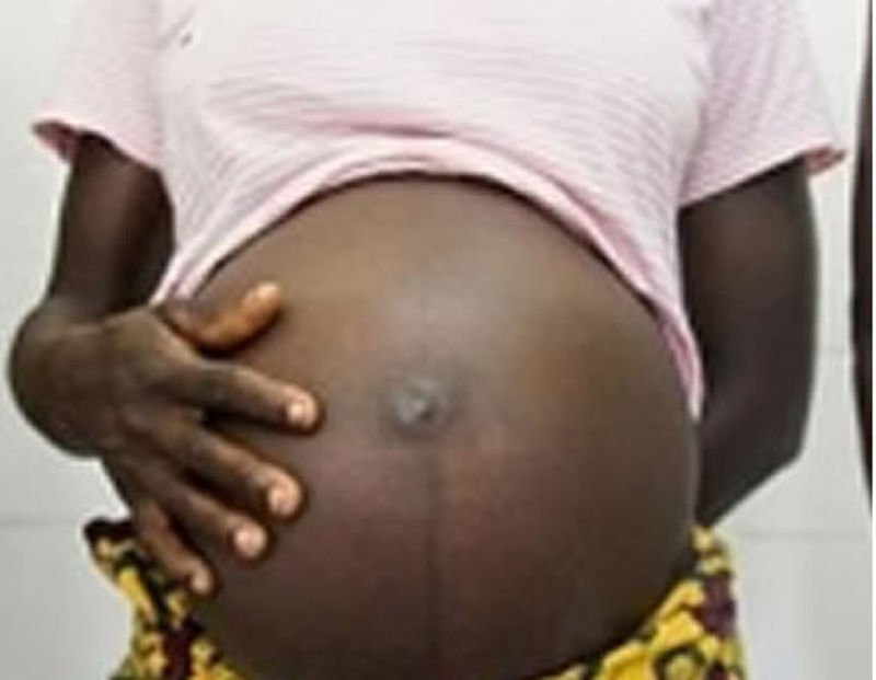 39-year-old father arrested for impregnating 13-year-old daughter
