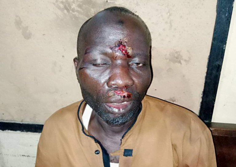 Four injured as traditionalists attack worshippers inside mosque