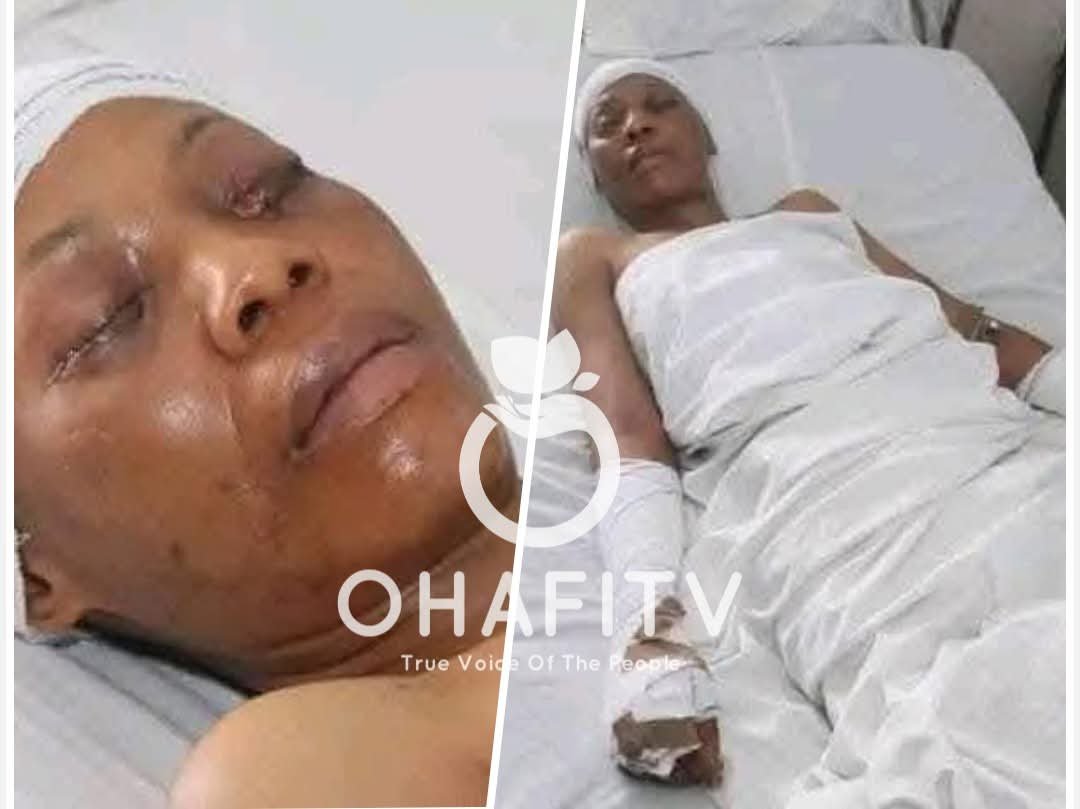 HORROR IN UMUAHIA: Husband Plucks Out Wife’s Eyes in Brutal Attack